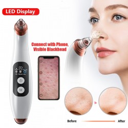 blackheads remover